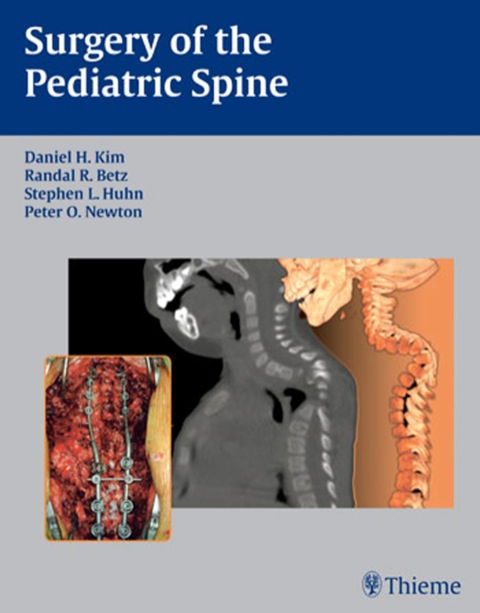 Cover image for book Surgery of the Pediatric Spine