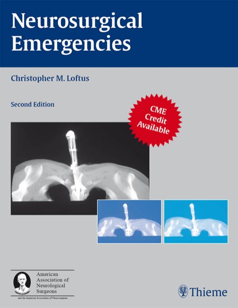 Cover image for book Neurosurgical Emergencies