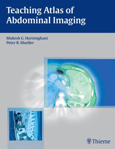 Cover image for book Teaching Atlas of Abdominal Imaging