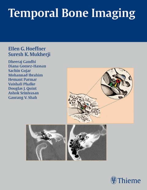 Cover image for book Temporal Bone Imaging