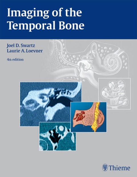 Cover image for book Imaging of the Temporal Bone
