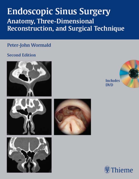 Cover image for book Endoscopic Sinus Surgery: Anatomy, Three-Dimensional Reconstruction, and Surgical Technique
