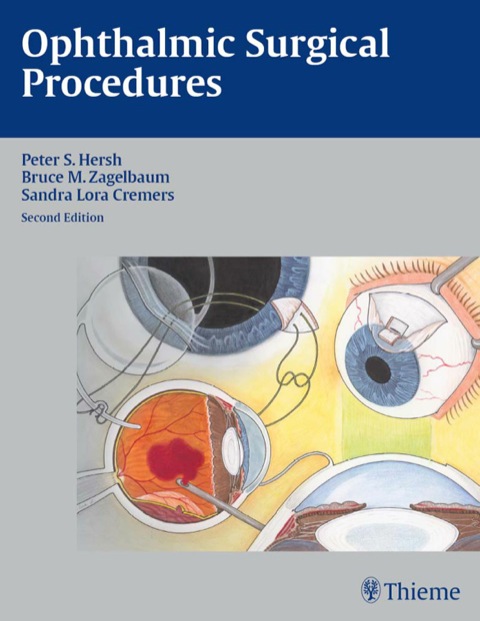 Cover image for book Ophthalmic Surgical Procedures