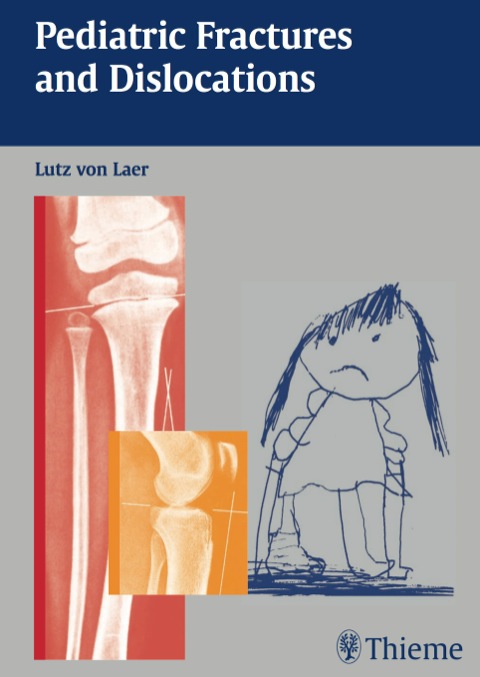 Cover image for book Pediatric Fractures and Dislocations