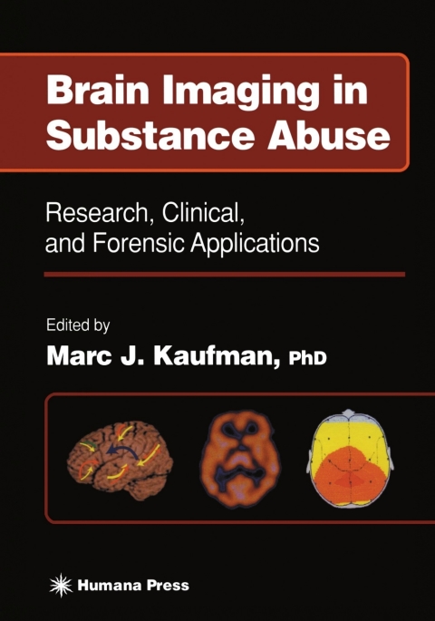 Cover image for book Brain Imaging in Substance Abuse