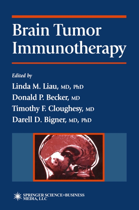 Brain Tumor Immunotherapy 