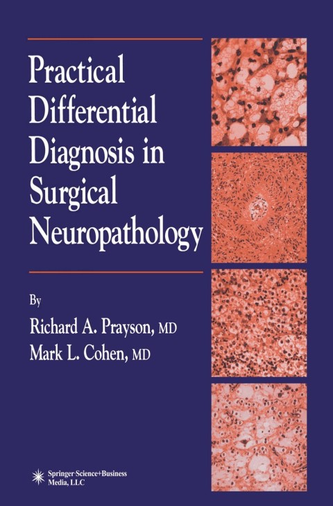 Practical Differential Diagnosis in Surgical Neuropathology 
