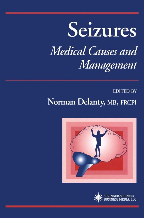 Cover image for book Seizures