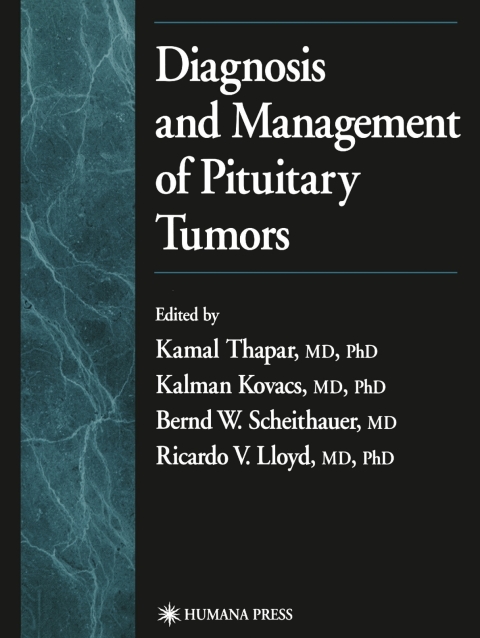 Cover image for book Diagnosis and Management of Pituitary Tumors