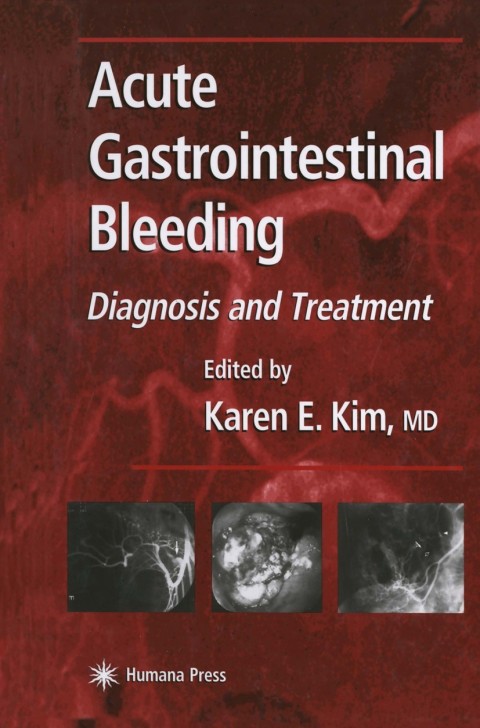 Cover image for book Acute Gastrointestinal Bleeding
