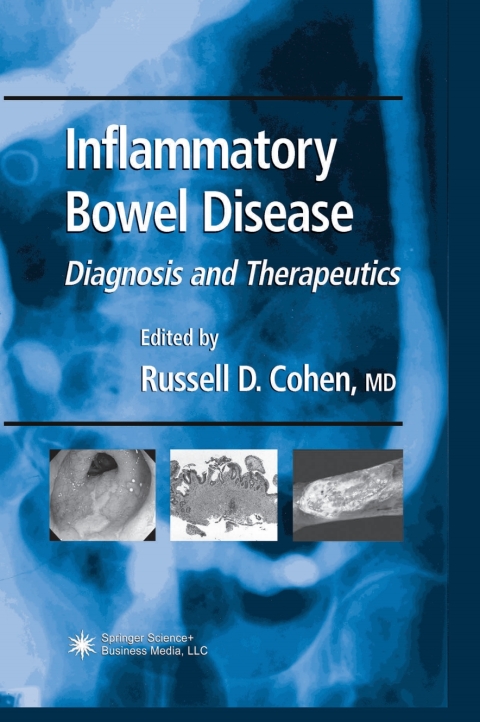 Cover image for book Inflammatory Bowel Disease