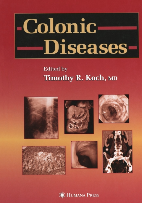 Cover image for book Colonic Diseases