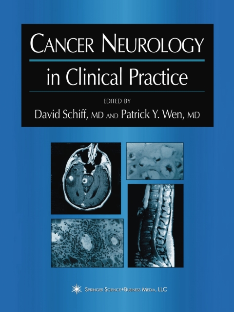 Cover image for book Cancer Neurology in Clinical Practice