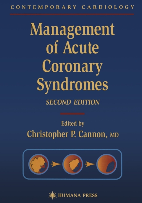 Cover image for book Management of Acute Coronary Syndromes