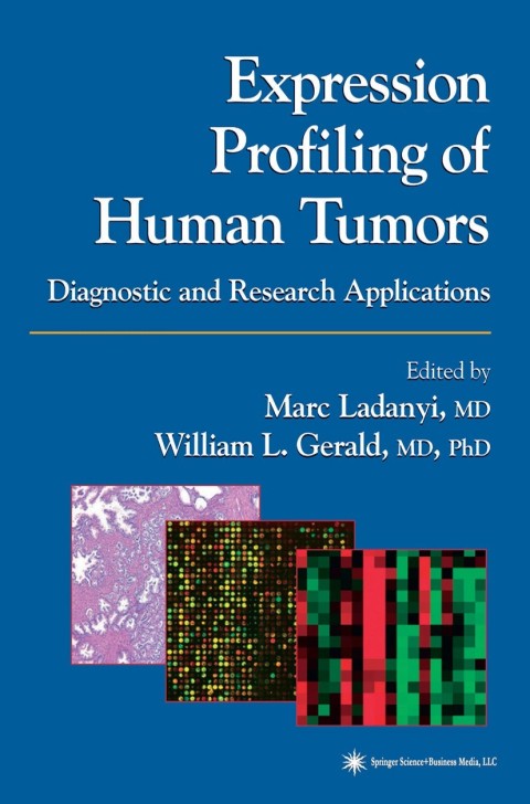 Cover image for book Expression Profiling of Human Tumors