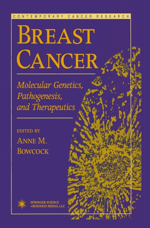 Cover image for book Breast Cancer