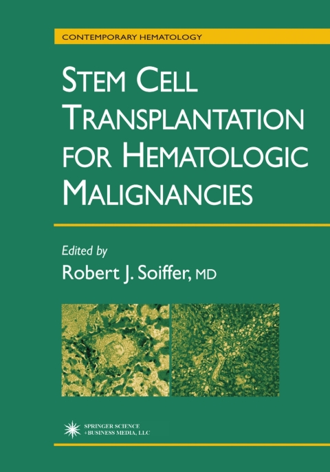 Cover image for book Stem Cell Transplantation for Hematologic Malignancies