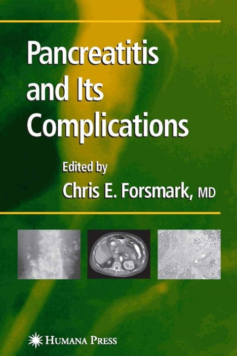 Cover image for book Pancreatitis and Its Complications