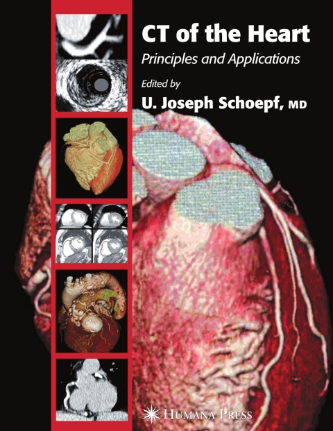 Cover image for book CT of the Heart