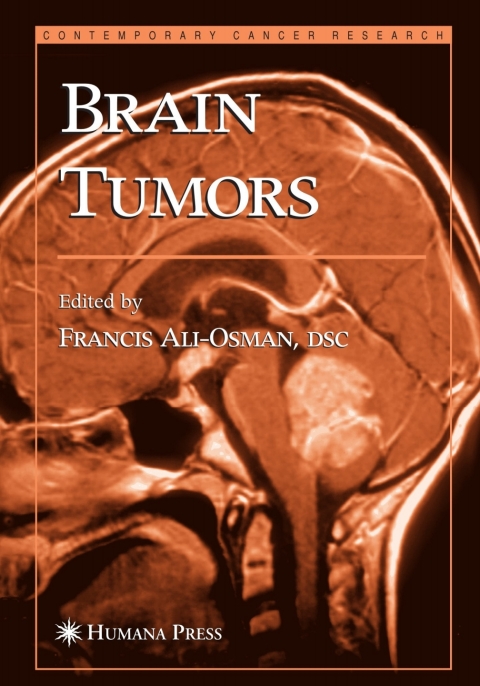 Cover image for book Brain Tumors