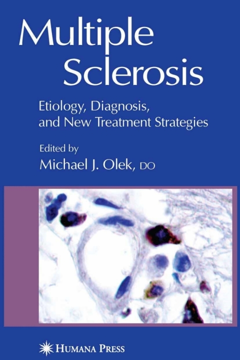 Cover image for book Multiple Sclerosis