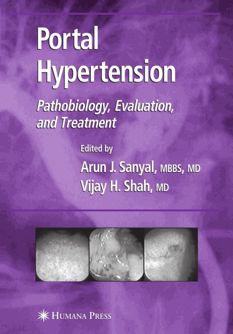 Cover image for book Portal Hypertension