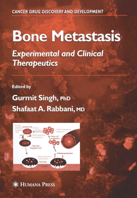Cover image for book Bone Metastasis