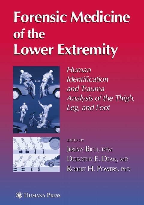 Cover image for book Forensic Medicine of the Lower Extremity