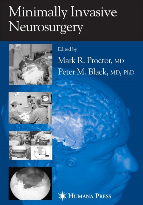 Cover image for book Minimally Invasive Neurosurgery