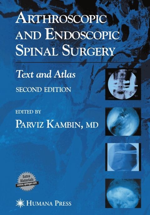 Cover image for book Arthroscopic and Endoscopic Spinal Surgery