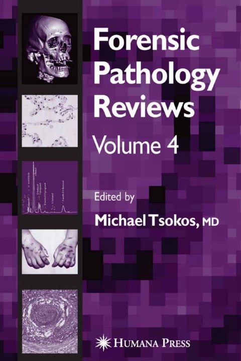 Cover image for book Forensic Pathology Reviews Vol    4