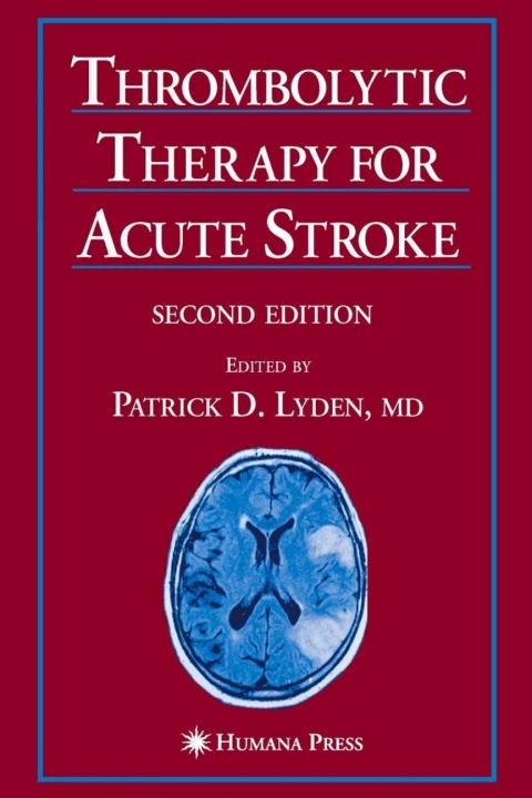 Cover image for book Thrombolytic Therapy for Acute Stroke
