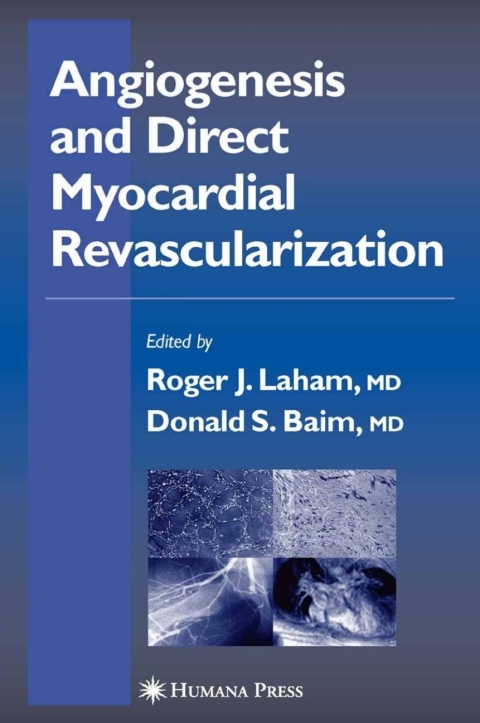 Cover image for book Angiogenesis and Direct Myocardial Revascularization