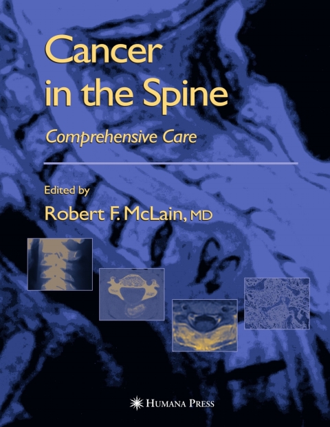Cover image for book Cancer in the Spine