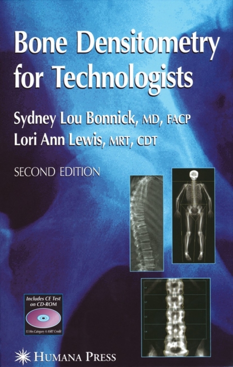 Cover image for book Bone Densitometry for Technologists