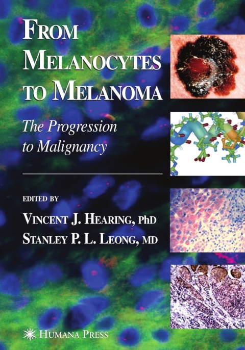 Cover image for book From Melanocytes to Melanoma