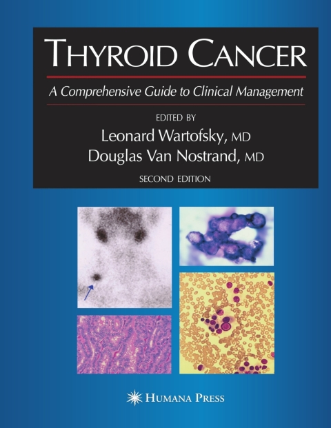 Cover image for book Thyroid Cancer