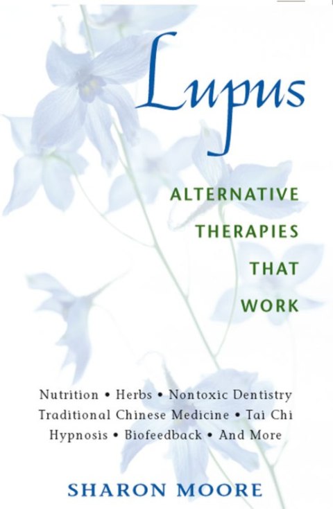 Cover image for book Lupus