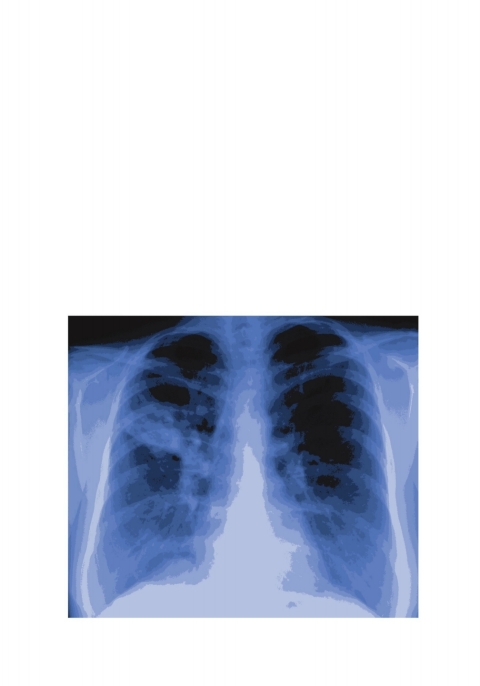 Cover image for book Bronchial Asthma