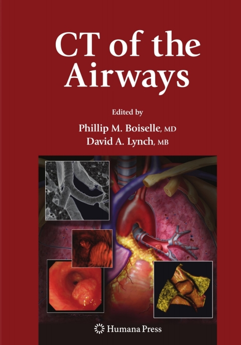 CT of the Airways 