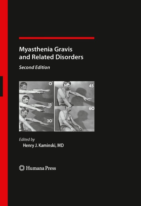 Cover image for book Myasthenia Gravis and Related Disorders