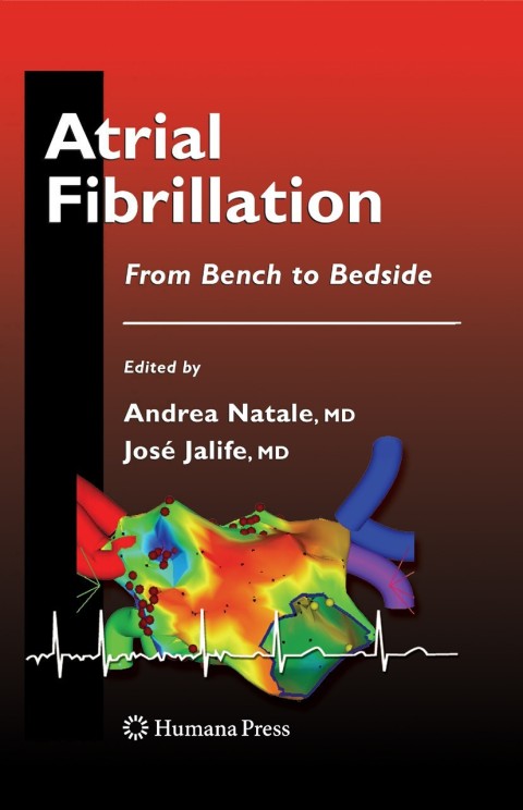 Cover image for book Atrial Fibrillation