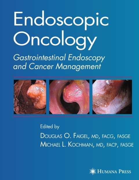Cover image for book Endoscopic Oncology
