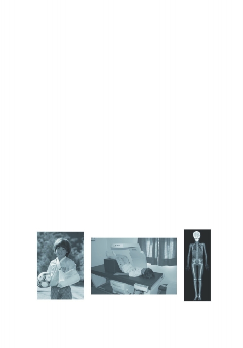 Cover image for book Bone Densitometry in Growing Patients