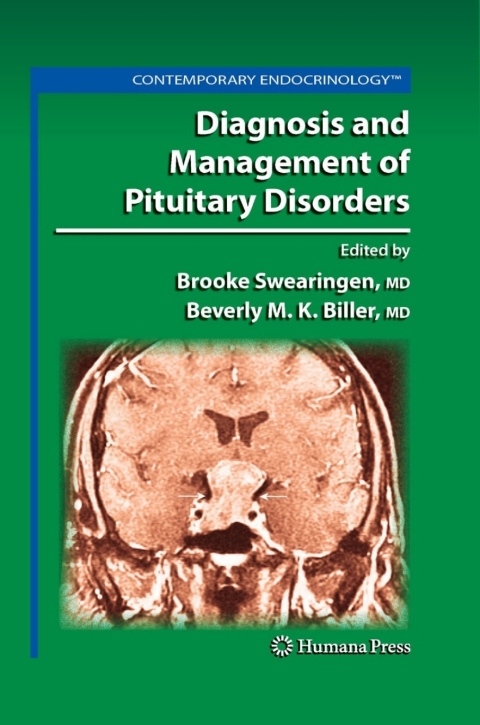 Cover image for book Diagnosis and Management of Pituitary Disorders