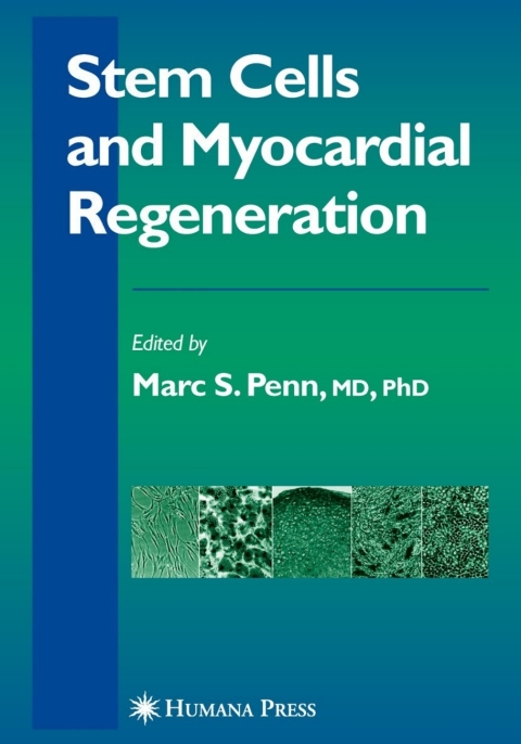 Cover image for book Stem Cells and Myocardial Regeneration