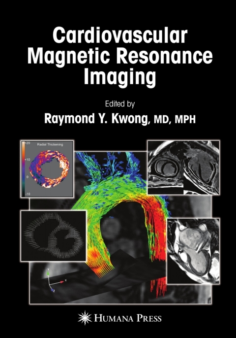 Cover image for book Cardiovascular Magnetic Resonance Imaging
