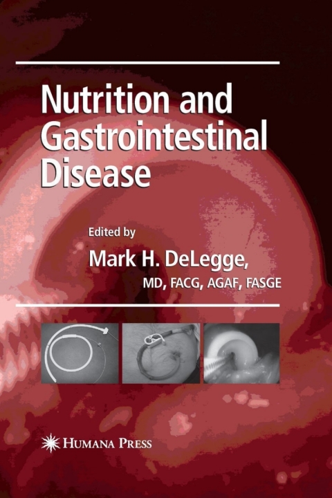Cover image for book Nutrition and Gastrointestinal Disease