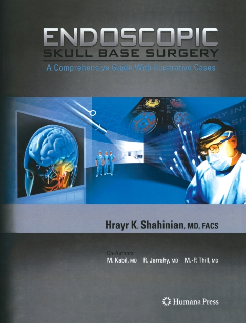 Cover image for book Endoscopic Skull Base Surgery