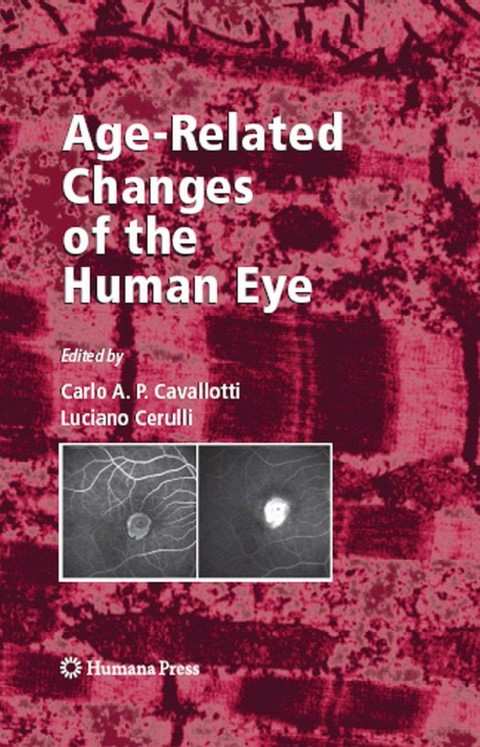 Cover image for book Age-Related Changes of the Human Eye